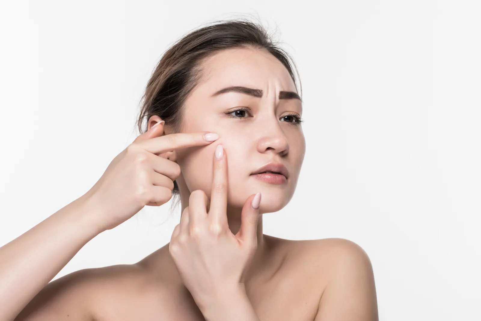 حب الشباب (Acne): الأسباب، الأنواع، والعلاج الفعّال — شرح لأسباب حب الشباب وعلاجاته الموضعية والفموية وأخطاء العناية الشائعة بالبشرة.